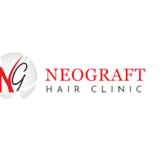 Neograft   Hairclinic