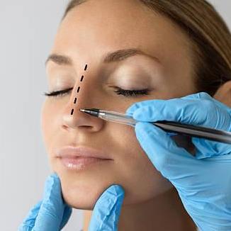 Rhinoplasty  In Riyadh